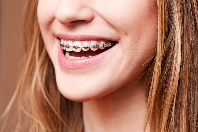 Orthodontics in Downey